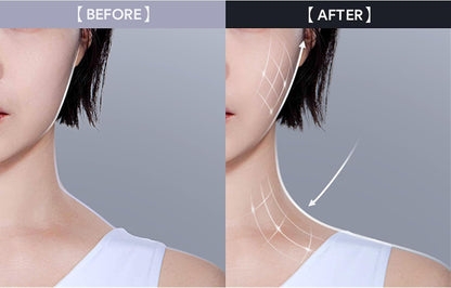 PetalLift™ - Facial Sculpting Ring